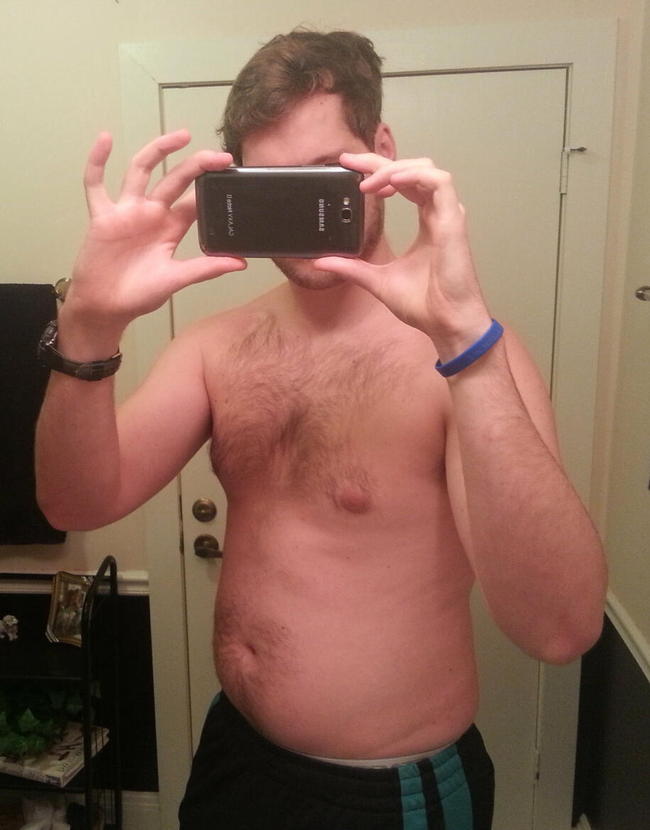 Before — during years of undiagnosed Lyme disease